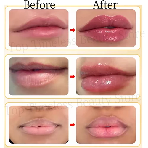Imagen 2 del producto Aceite esencial para rellenar los labios instantáneos, nutritivo, antiarrugas, hidratante, cuidado de los labios Sexy, brillo de labios carnoso definitivo, suero, cosméticos