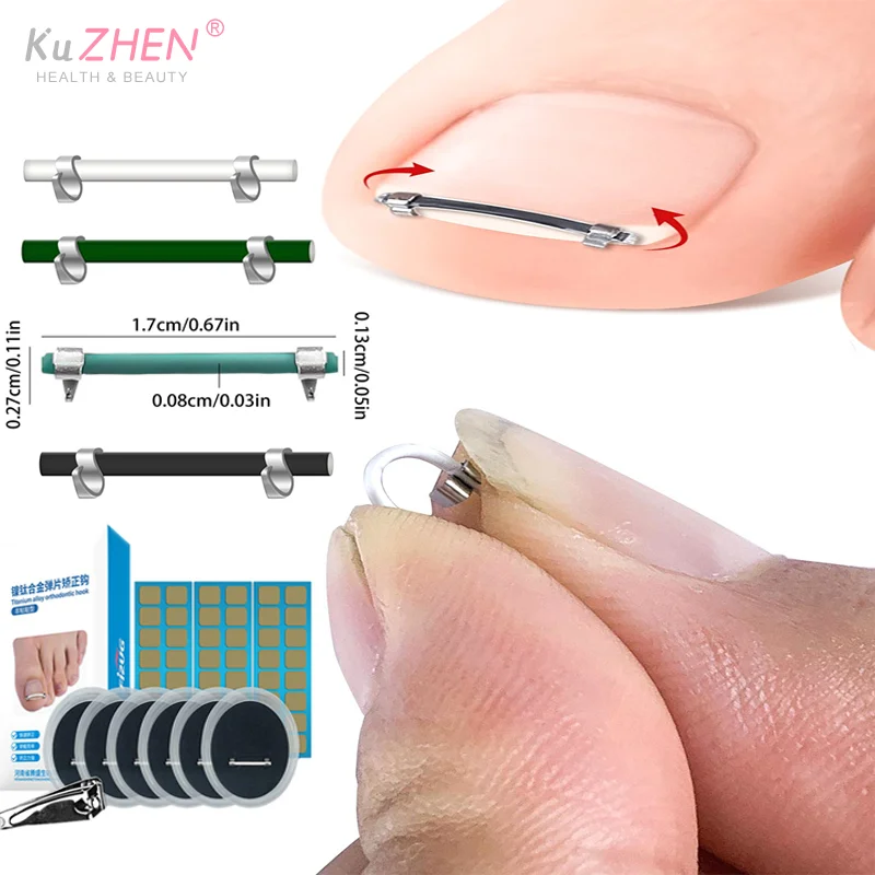 Ingrown Toenail Pedicure Tool Embed Toe Nail Care Straightening Correction Clip Curved Clamp Toenails Correction Tool For Toes