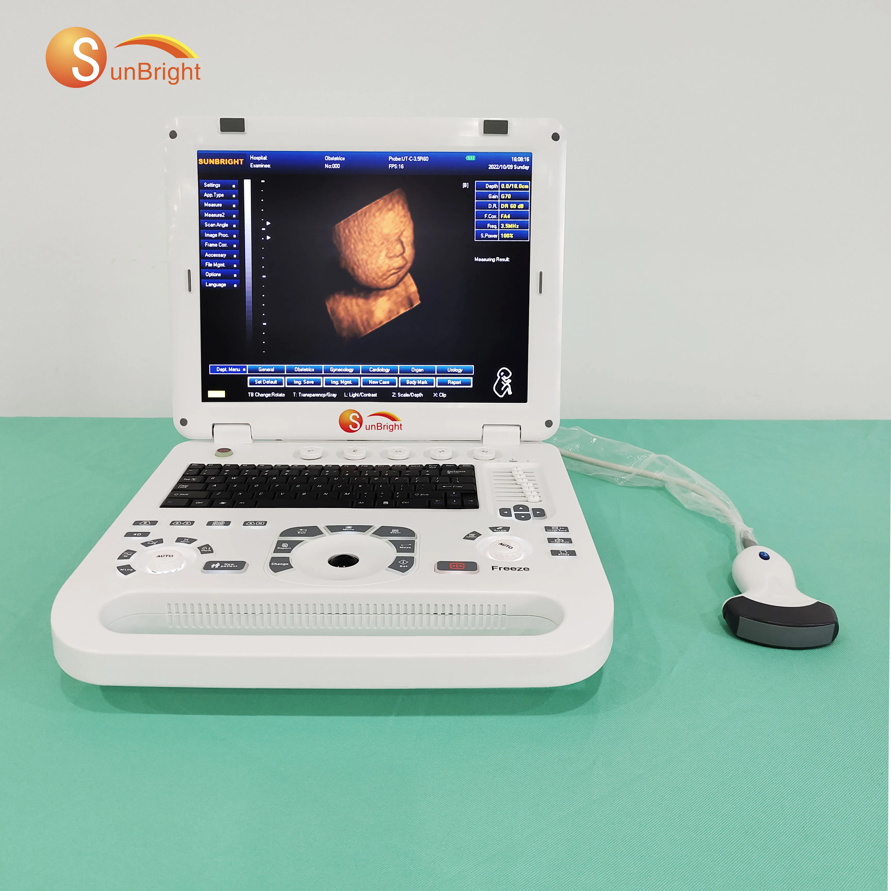 Medical Portable 3D Obstetric Digital OB/GYN Ultrasound machine