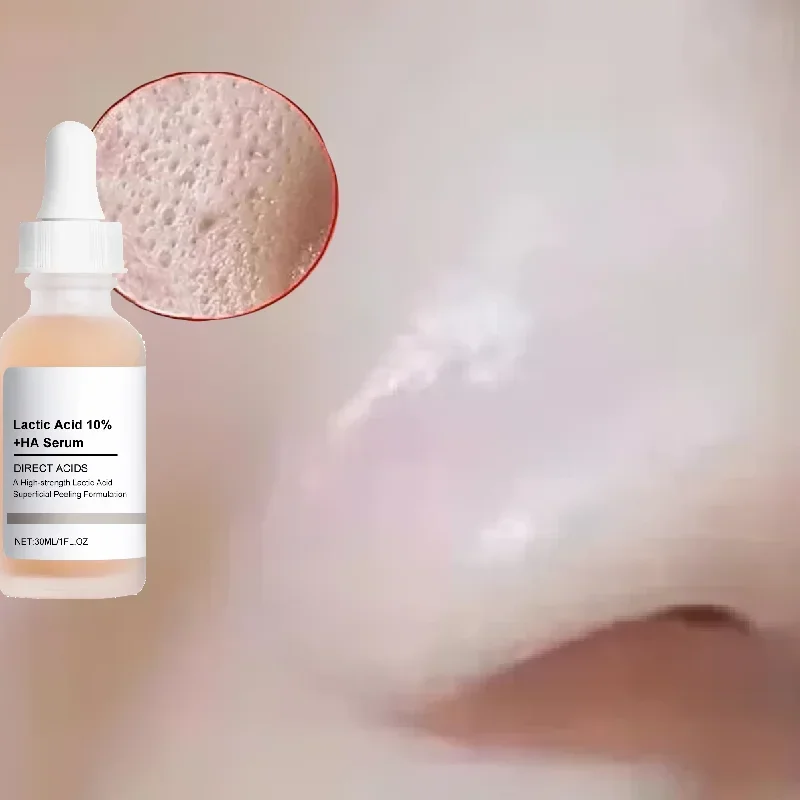 

Большая эссенция для пор, молочная кислота, продукт для сужения пор на лице, укрепляющий поры и гладкий корейский уход за кожей