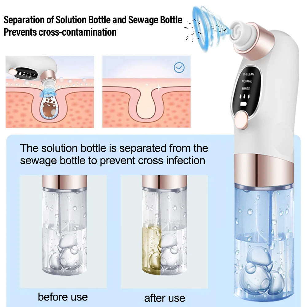 Aspirateur électrique Rechargeable pour points noirs, nettoyeur de pores du visage, nettoyeur de boutons et de points noirs, Machine de nettoyage en profondeur de la peau