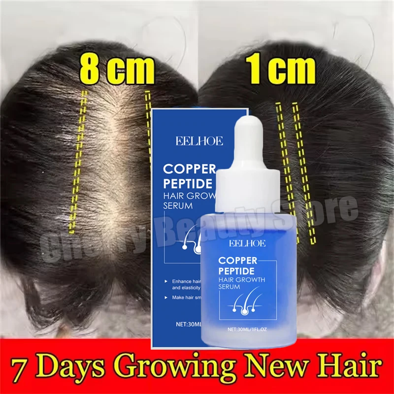 

Hair Growth Serum Anti Hair Loss Thicken Hydrating Scalp Treatment Beard Hair Follicles Nourishing Repair Hair Root Care Women M