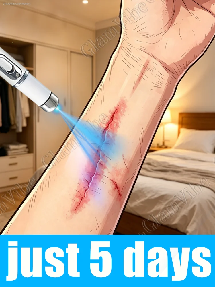 

2026 Aʟʟ-Nᴇᴡ Nᴀɴᴏ Bʟᴜᴇ Lɪɢʜᴛ Pᴇɴ: Double the Repair Power—Improve Stubborn Imperfections with a Single Touch.+985-*+8+-+**9