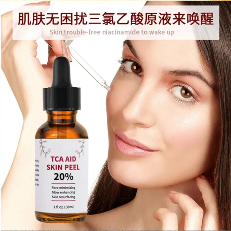 20% TCA Aid Skin Peel Pores 30ml Trichloroacetic Acid Stock Solution Minimizing Blackheads Solution Improve Shrink Pores