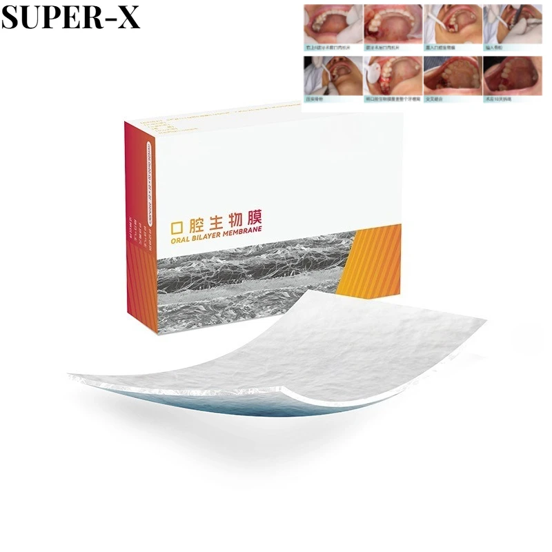 1PC Dental Oral Biofilm Relieve for Discomfort Inside The Mouth Repair Alveolar Bone Defects Dental Absorbable Collagen Membrane