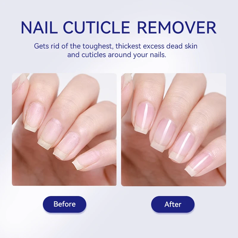 LILYCUTE 30ml dissolvant de cuticules Gel adoucissant rapide pour les ongles peau morte dissolvant doux soin de manucure outil de nettoyage de cuticules facile