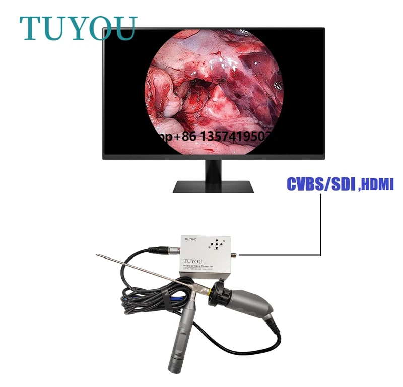 

Portable 1080P Full HD Medical Endoscopy ENT Laparoscopic Imaging Converter Endoscopy Processor