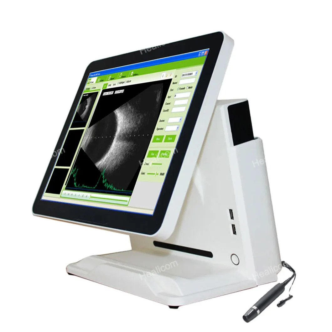 Hot Sale Ophtalmology Equipment Portable A / B Scan Ophthalmic Ultrasound Machine