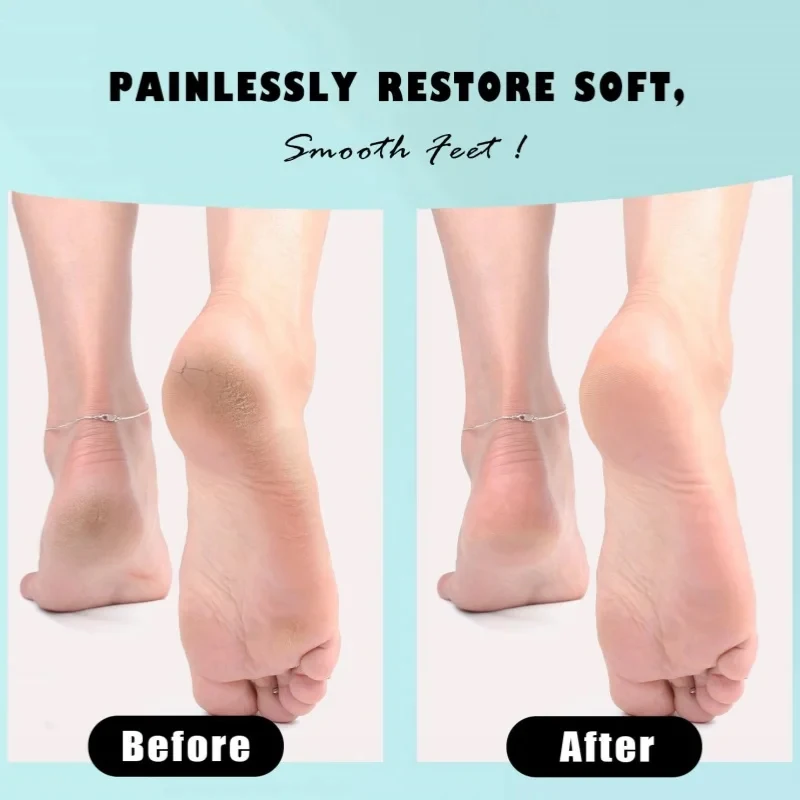 ماكينة تشذيب القدم الاحترافية عالية الجودة من زجاج النانو، أداة باديكير لتقشير القدم، أداة فرك وطحن القدم #4