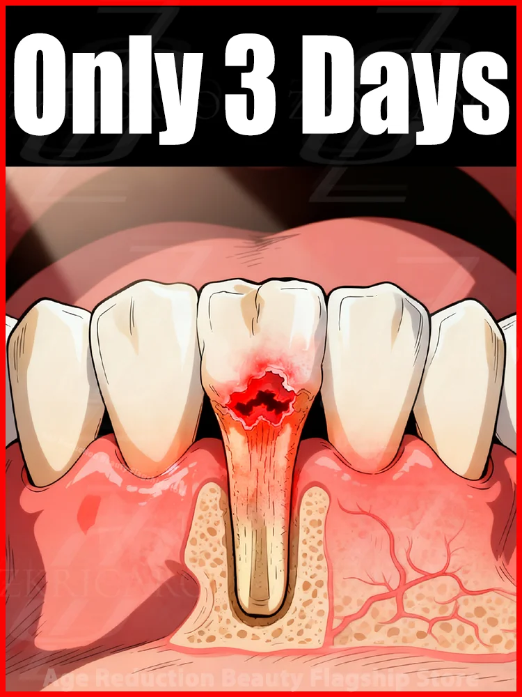 

When gums are swollen, inflamed, or painful, ⁱᵐᵐᵉᵈⁱᵃᵗᵉˡʸ ᵃᵖᵖˡʸ ᵍᵘᵐ ᶜᵃʳᵉ ᵉˢˢᵉⁿᶜᵉ ᵗᵒ ʳᵉᵍᵉⁿᵉʳᵃᵗᵉ ᵍᵘᵐˢ ᵃⁿᵈ ᶜᵒᵛᵉʳ ᵗᵉᵉᵗʰ ᵉᶠᶠᵒʳᵗˡᵉˢˢˡʸ