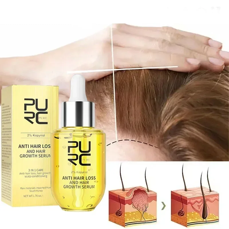 

Hair Growth Oils For Man Women Ginger Anti Hair Loss Fast Regrowth Thicken Oils Scalp Treatment Hair Care Products