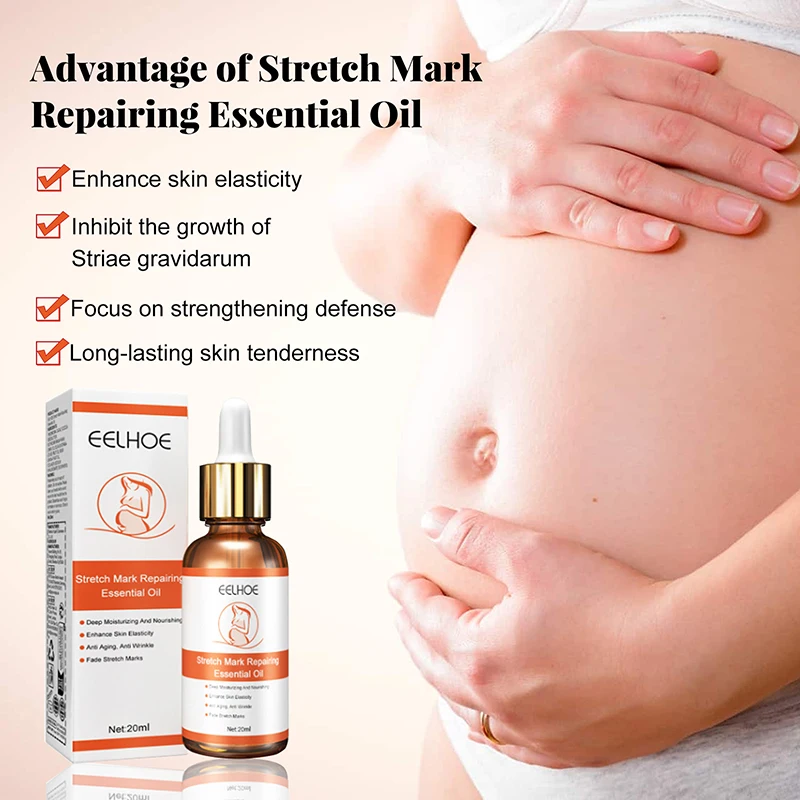 Stretch Marks Remover น้ํามันหอมระเหยการตั้งครรภ์คลอดบุตรใหม่เก่า Stretch Mark Removal Serum เพิ่มความยืดหยุ่นของผิว 20ml