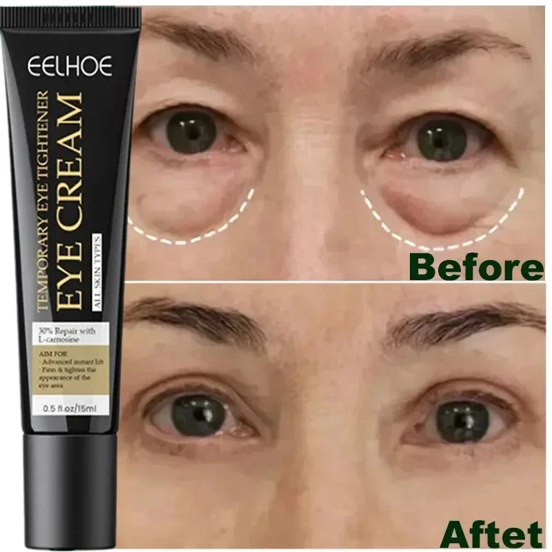 7 Day Remove Eye Wrinkles Eye Cream Lifting Firming Fat Bags Tighten Puffiness Smooth Nourish Eye Skin Care Eye Korean Makeup