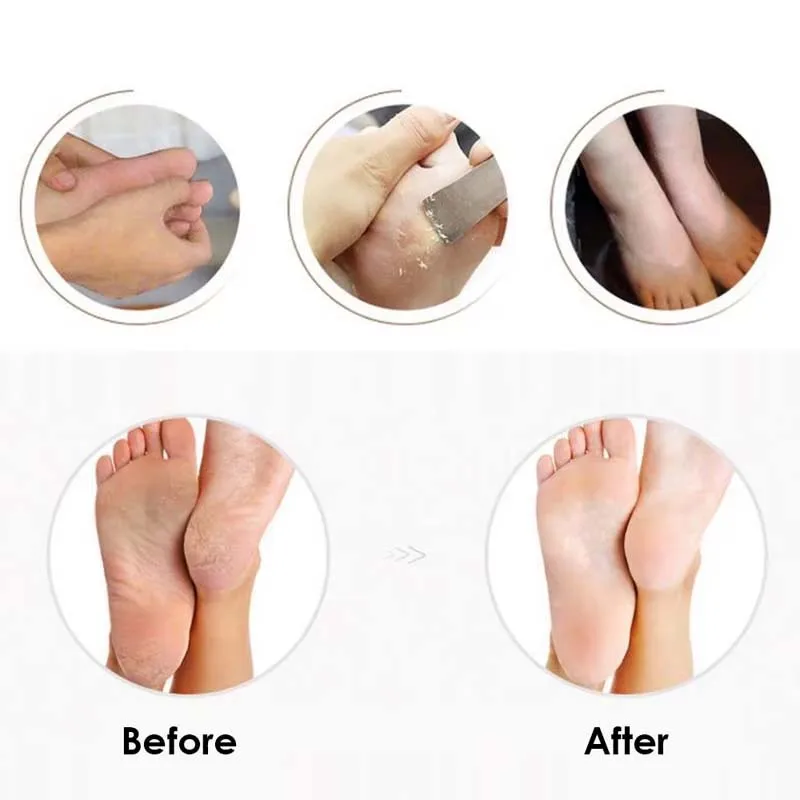 전문가용 핫세일 페디큐어 플래너 USB 충전 발 각질 제거기 발 그라인더 교체 헤드 발 각질 제거기