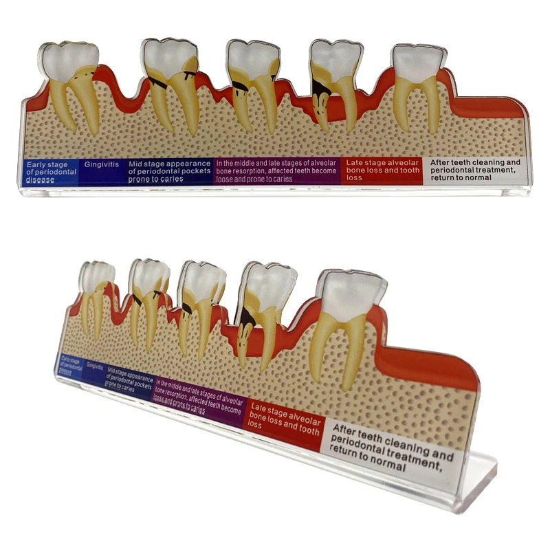 Thumbnail 4 - #68 Dental Teaching Models List of Top Picks