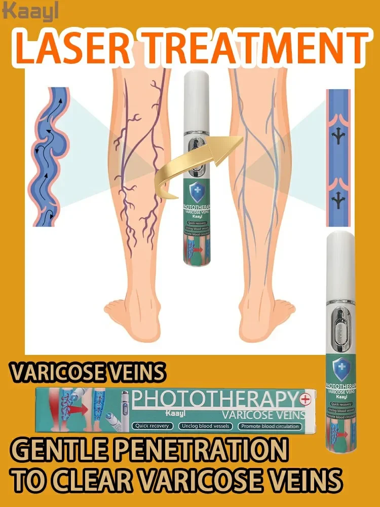 

Blue Light Laser | for Anyone with Sedentary or Standing | Improves Blood Circulation