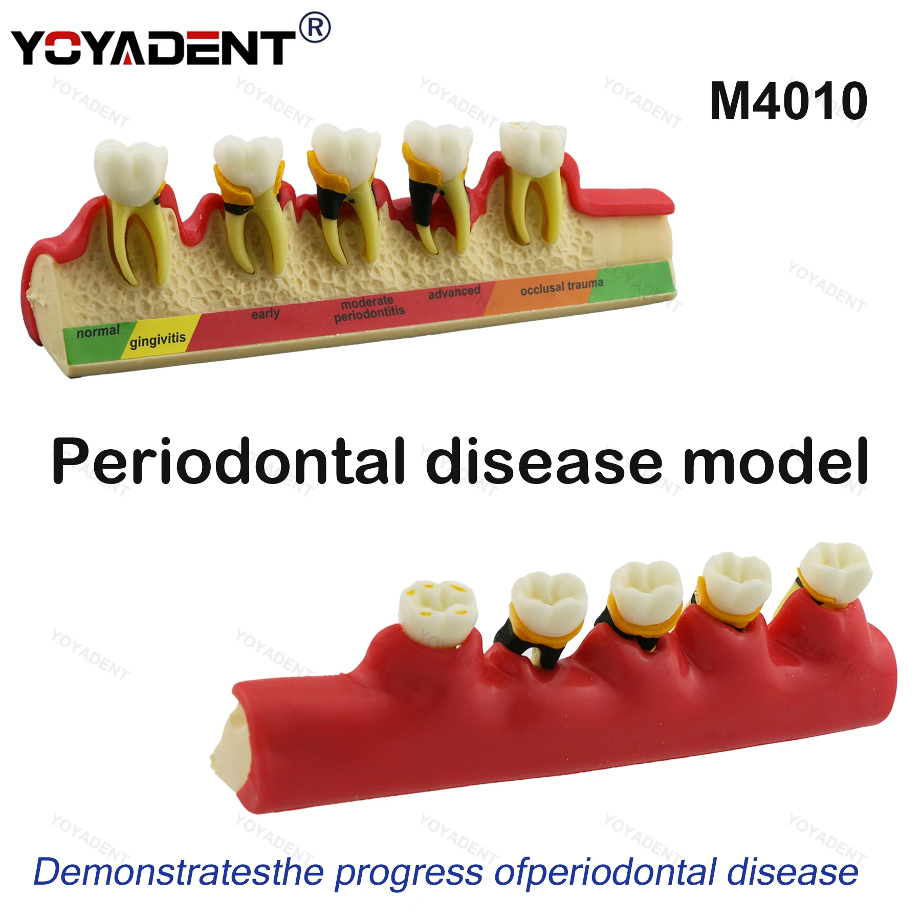 Dental Teeth Model … - image