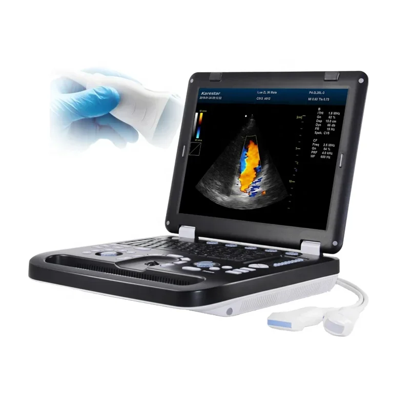 China Medical  Laptop 3D 4D Color Doppler Portable Ultrasound Scanner Machine Price