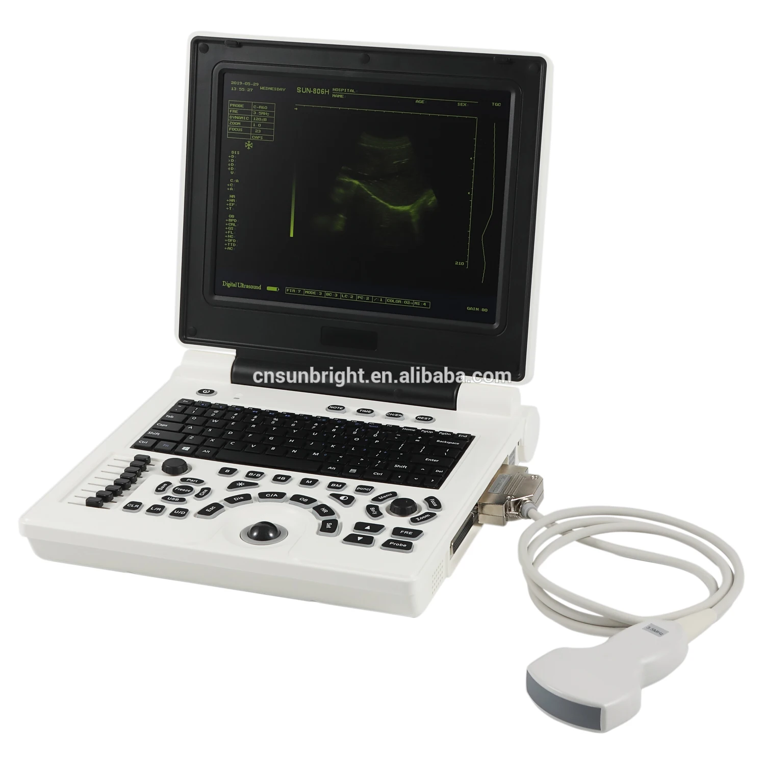 

CE Portable doppler ultrasound ecografo portable devices ultrasound portable with low price