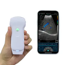Wireless Ultrasound Probe for Android IOS Apple Google Play Windows Systems 3-in-1 Double Heads 128 Elements Color Doppler Probe