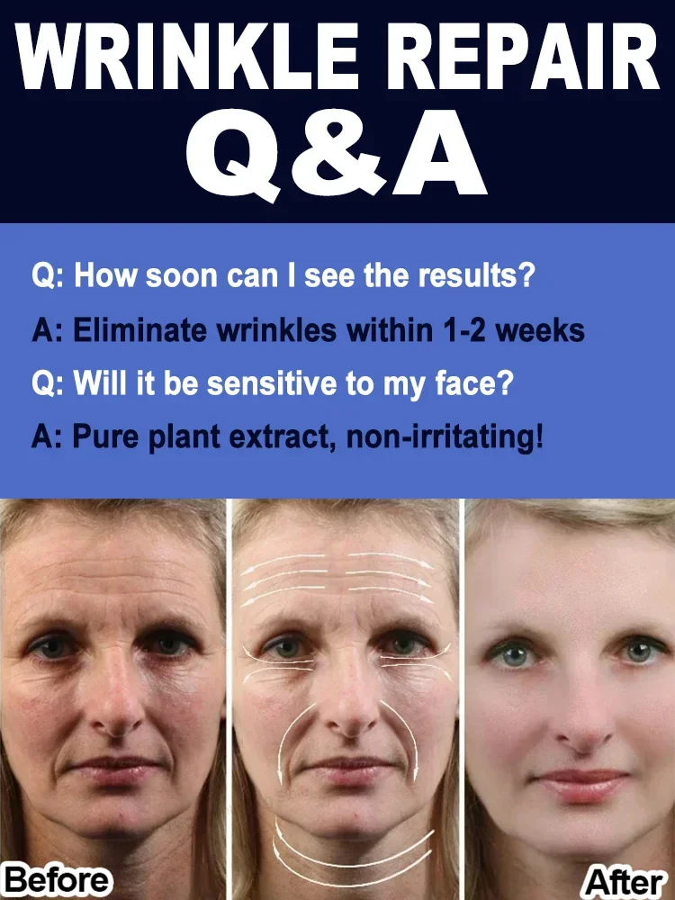 

Морщины исчезают 20-летний младший