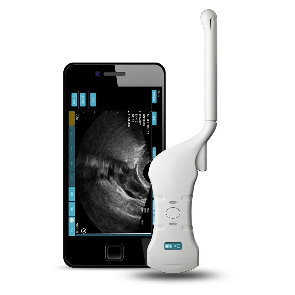 

2025/портативный мини-ручной сканер, электрическое оборудование для гинеколога, двойной зонд, выпуклый зонд, трансгина