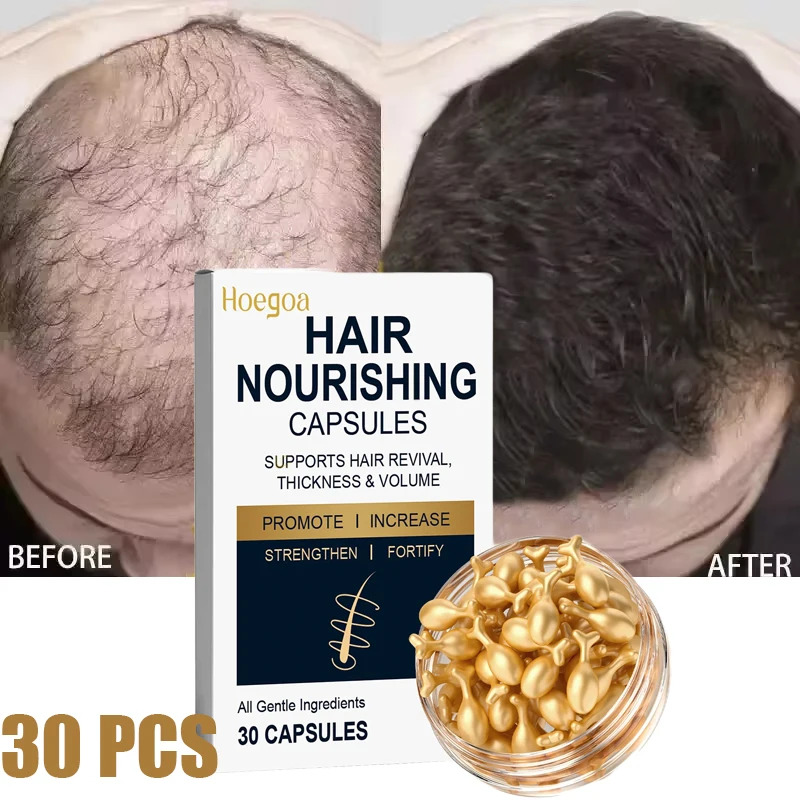 

Hair Growth Capsule Serum Hair Regrowth Essential Oil Anti Hair loss Repair Damaged Scalp Women Men Anti Baldness Hair Care