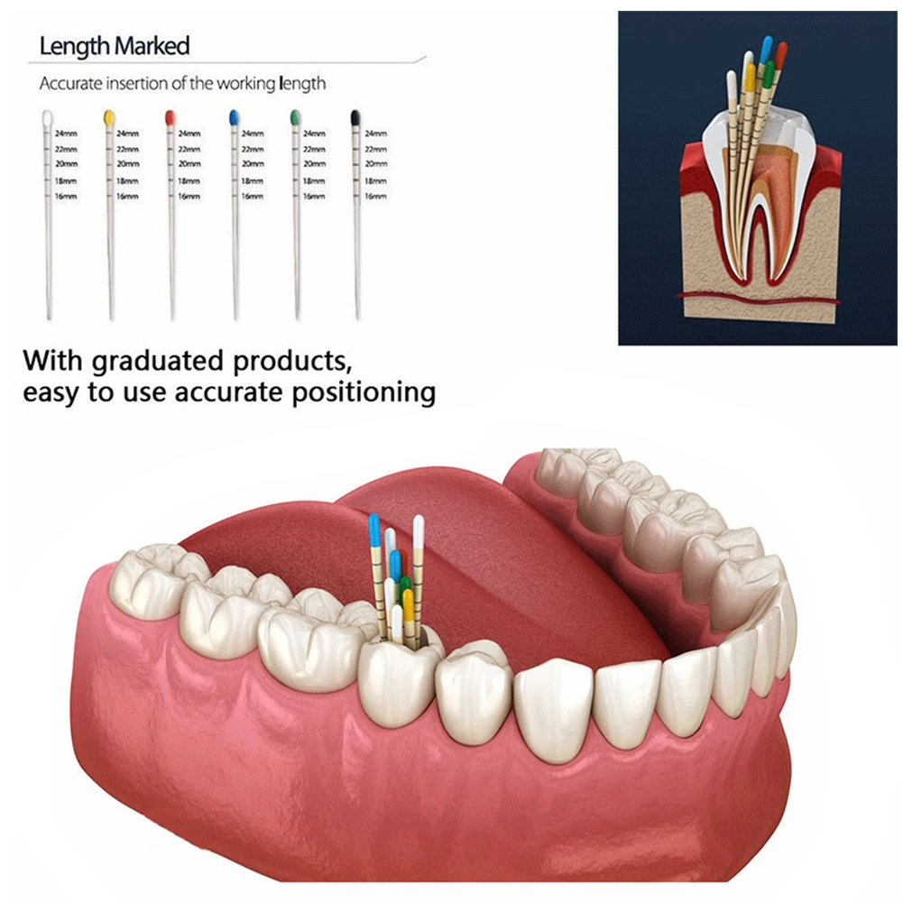 Puntos de papel absorbentes dentales graduados, puntas de fibra de algodón absorbentes Endo para conducto radicular, postes cónicos Protaper para dentista 02/04/06/F Taper