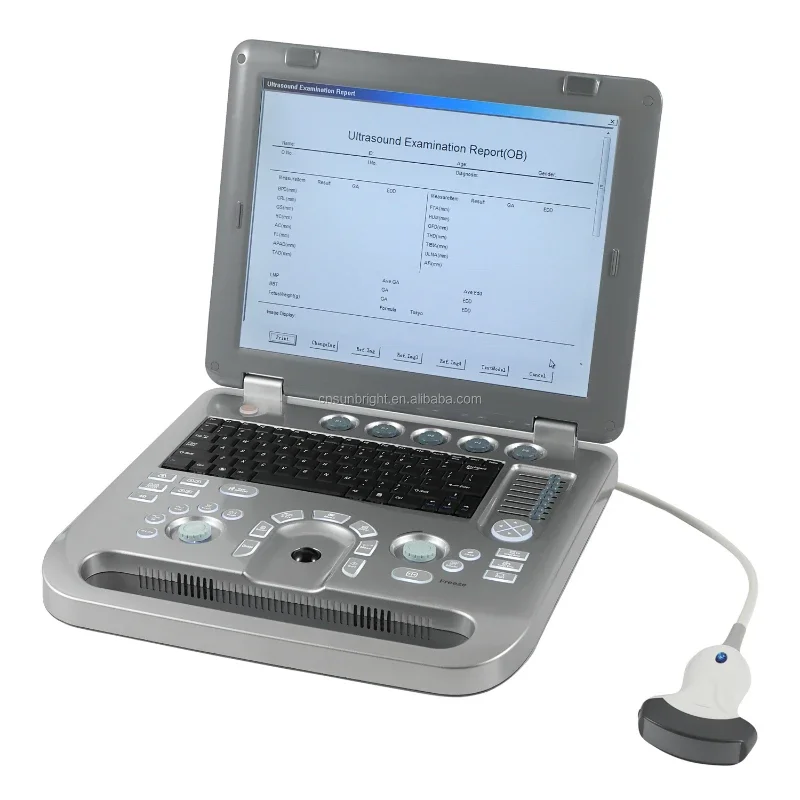 Animal ultrasound diagnose  portable vet digital canine ultrasound machine