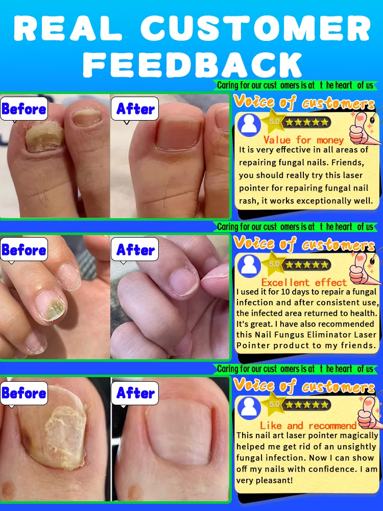 Les ongles deviennent sains et lisses sans avoir à se soucier des mycoses.