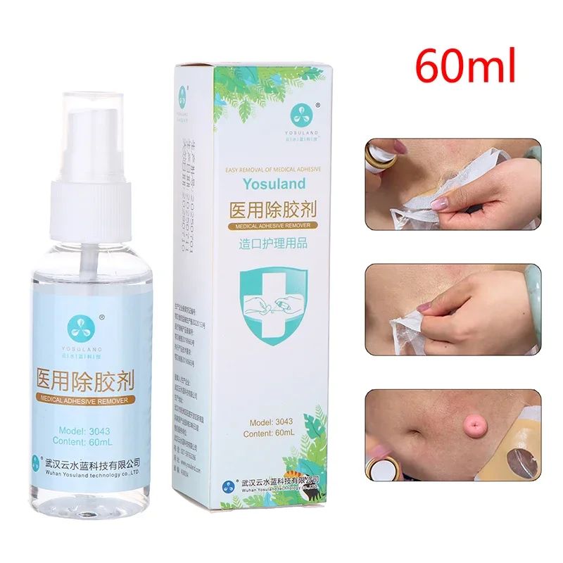 

60 мл колостомический клей, протирающий спрей, медицинское средство для удаления клея, средства по уходу за мешком для стомы