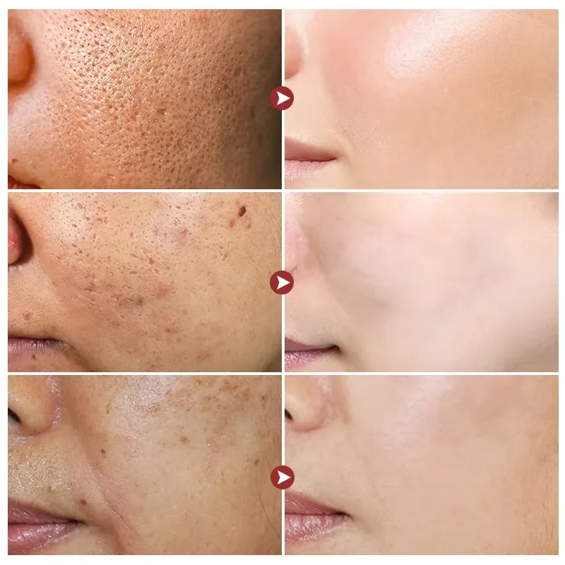 Weiße Reis aufhellung creme Anti-Aging verblassen feine Linien Gesichts creme Melanin pigment entferner verbessern stumpfe feuchtigkeit spendende Hautpflege