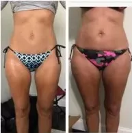 

EMS RF MYOslim 6500 Вт машина для похудения тела NEO профессиональное оборудование для наращивания мышц сжигание жира EMS стимулятор мышц