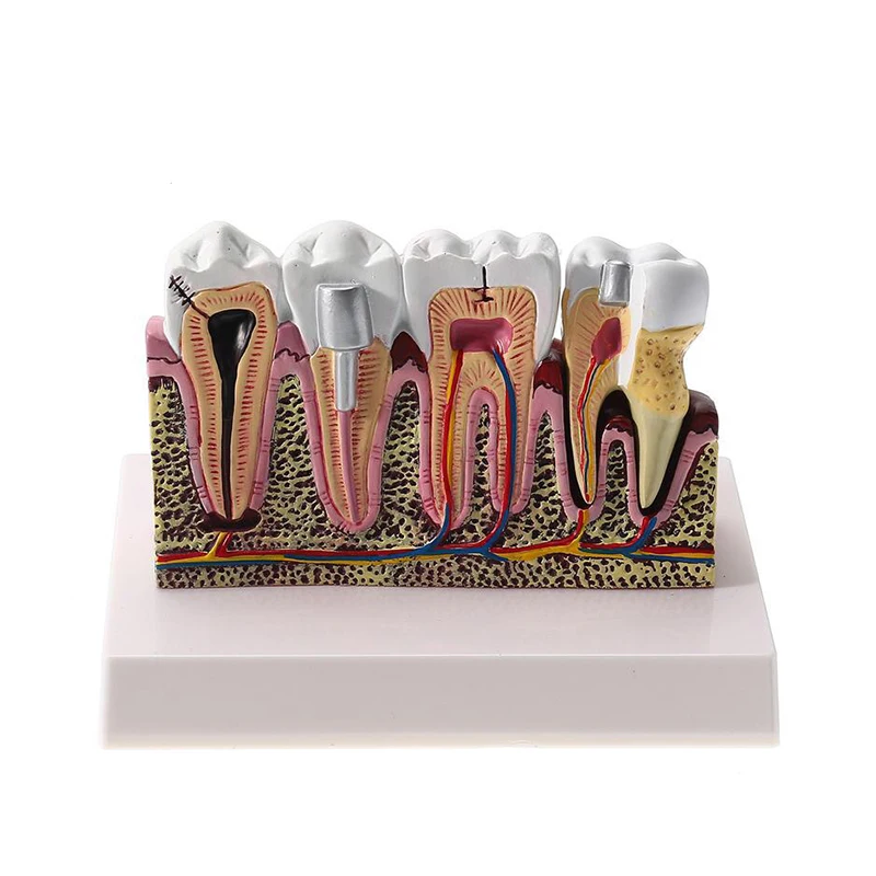 W pełni anatomiczny Model zębów do nauki nauczania demonstracja dentysta modele dentystyczne do edukacji pacjentów produkty stomatologiczne