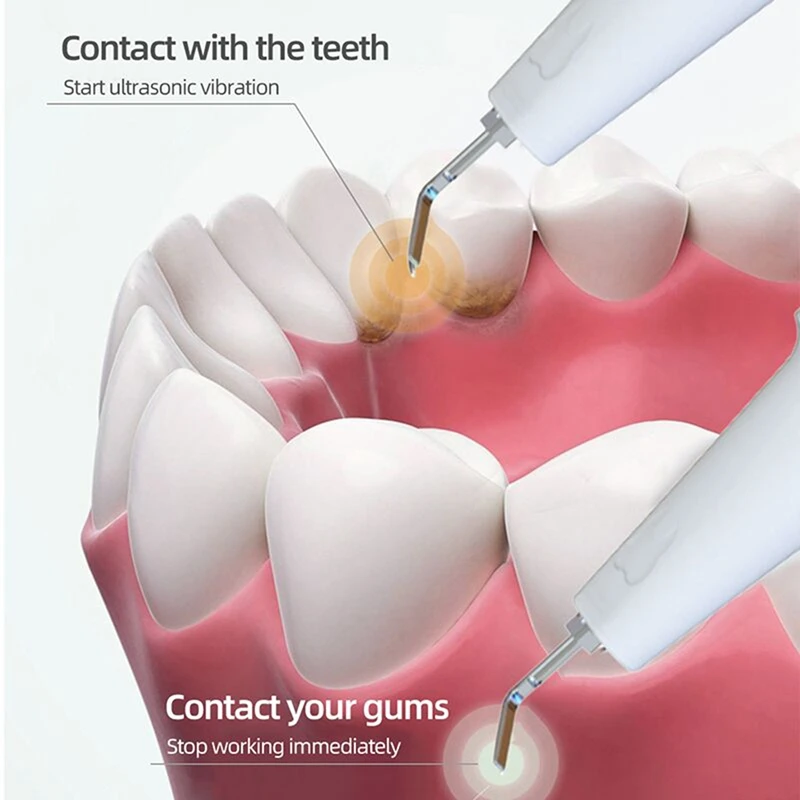 Nettoyeur de Dents à Ultrasons, Connexion Wifi, Dissolvant de Tartre Dentaire, pour Mise à Niveau Électrique