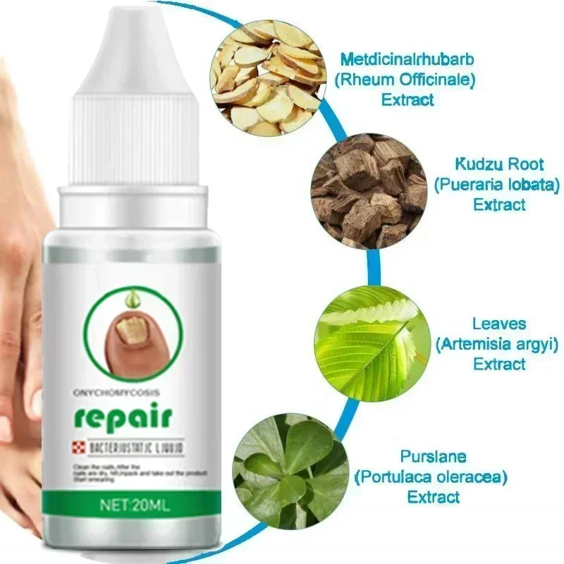 Strong Nail Fungus Treatment Serum Essence oil Feet Nails Repair Care Essence Cream Anti Infection Toe Fungal Removal