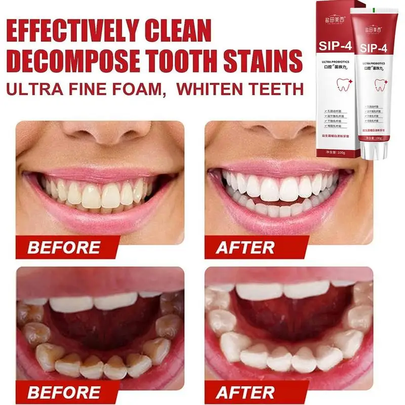 Sip-4 Probiotic Whitening Toothpaste Brightening & Stain Removing Sp-4 Probiotic Toothpaste Fresh Breath Teeth Whiten Toothpaste