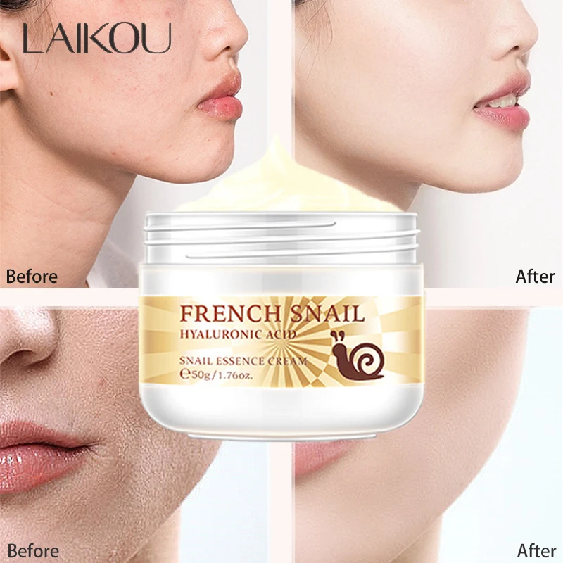 

Snail Face Cream Improve Dry Rough Skin Wrinkle Brightening Facial Hyaluronic Acid Moisturizing Nourishing Serum Skin Care