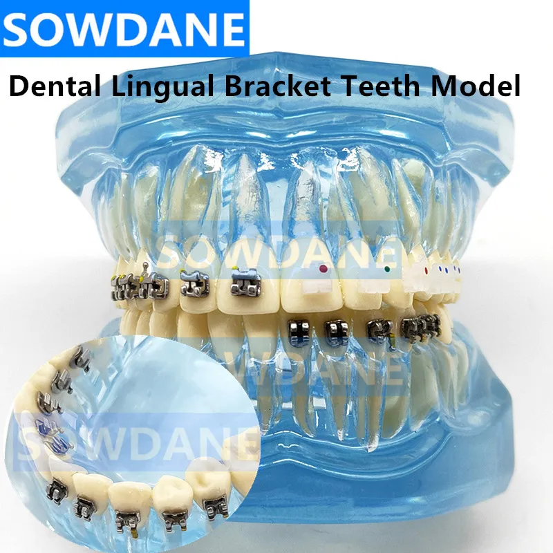 

Dental Orthodontic Teeth Model with Lingual Bracket Ceramic and Metal Brackets for Patient Communication Dental Study Tooth Mold