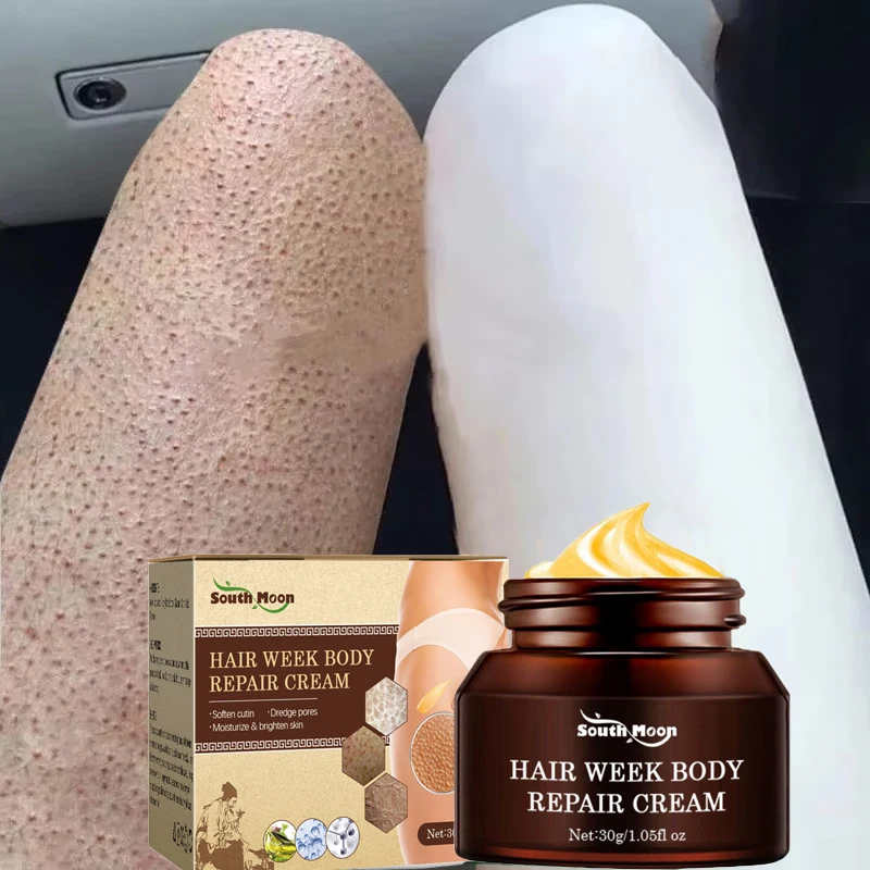 Chicken Skin Repair Cream Curing Keratosis Follicle Pilaris Body Dark Spot Remove Thick Pores Moisturizing Smooth Essence Lotion