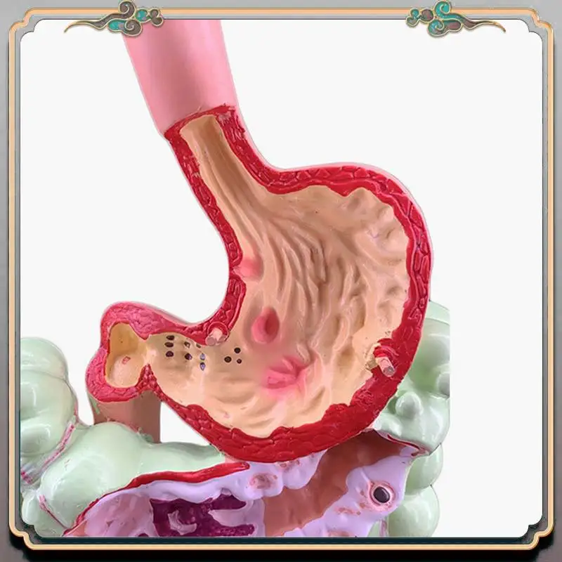 A46M-5X Human Digestive System Model Stomach Anatomy Large Intestine Cecum Rectum Duodenum