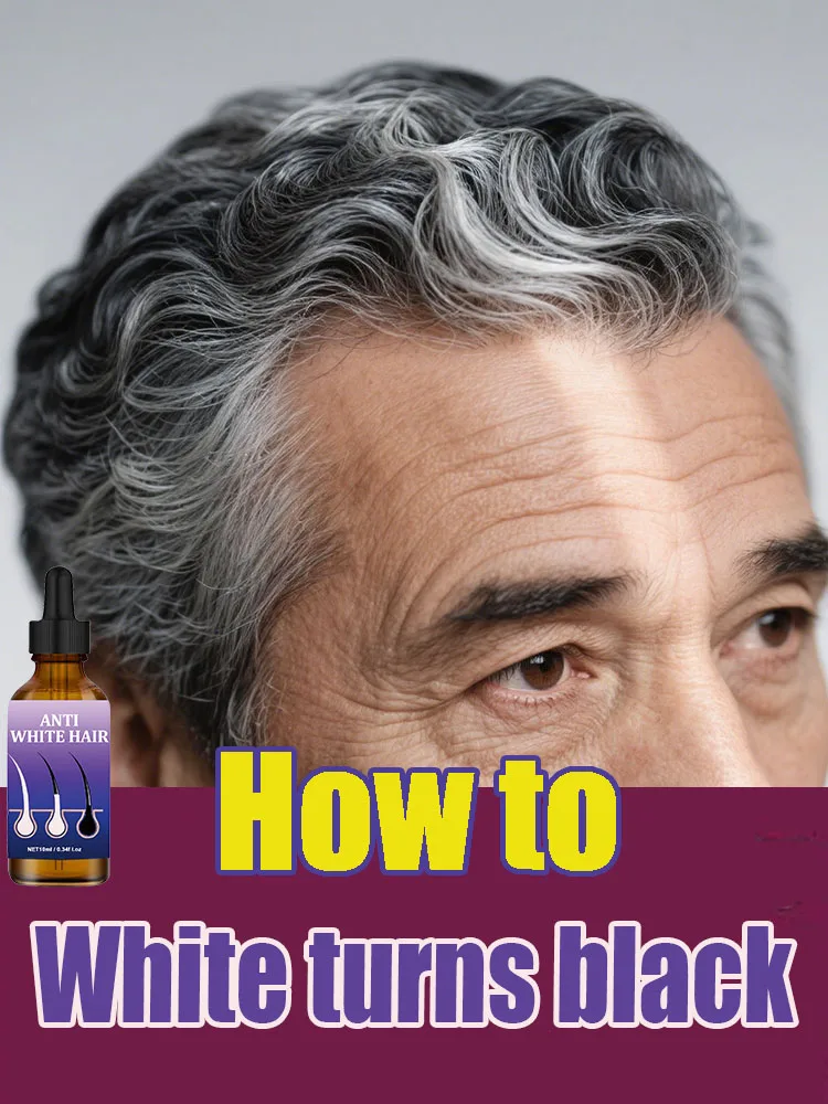 

3ND White To Black Serum Natural Color Repair Nourish Essence Anti Loss Care for Men Women Anti Gray Hair Products