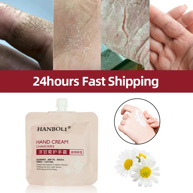 

Hand Cream Whitening Moisturizing Hands Dry Cracked Repair Anti Foot Drying Crack Wrinkle Removal Chamomile Lotion Skin Care