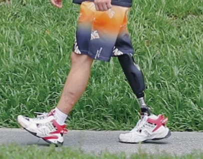 Bionic Hydraulic Knee Joint Class 3 CE ISO Certified for Artificial Limb Prosthetic Leg Fast Handling Quick Ship Reliable