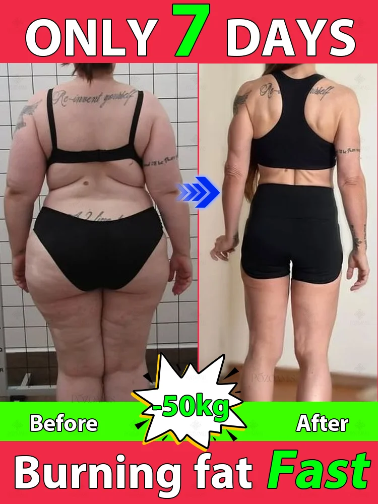 

The best ᴡᴇɪɢʜᴛ ʟᴏss ᴀɴᴅ ғᴀᴛ ʙᴜʀɴɪɴɢproduct in 2025, ʀᴇᴅᴜᴄᴇ ʙᴇʟʟʏ, ᴀʀᴍ ᴀɴᴅ ʟᴇɢ ғᴀᴛ,