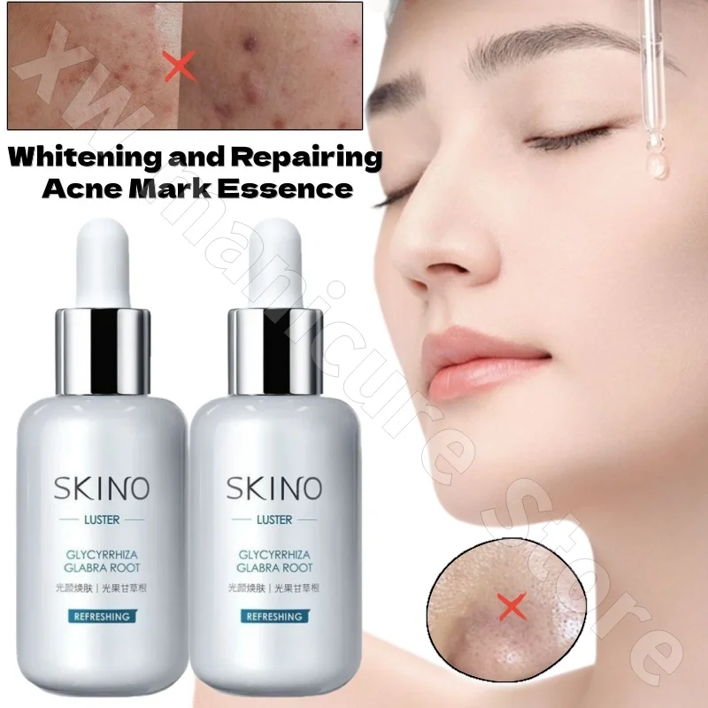 

Skin Repair Essence 3.0 Fades Red and Black Acne Marks Soothes Repairs and Improves Dullness Niacinamide Essence 30ml