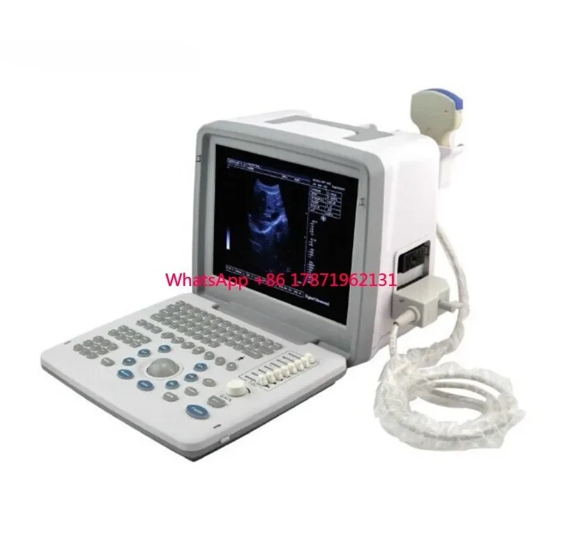 Pocket Portable Laptop Ultrasound Prices Special Design Full Digital LED Machine