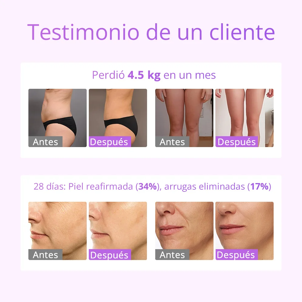 آلة التخسيس يبو جديد وصول 5 في 1 30K التجويف بالموجات فوق الصوتية للاستخدام المنزلي محدد شكل الجسم فراغ آلة تردد الراديو #3