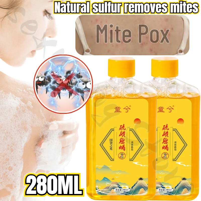 Mite Removal Shower Gel Deep Cleaning Back Sulfur Mite Removal Liquid Soap Cleansing Skin Moisturizing Rejuvenation Body Wash