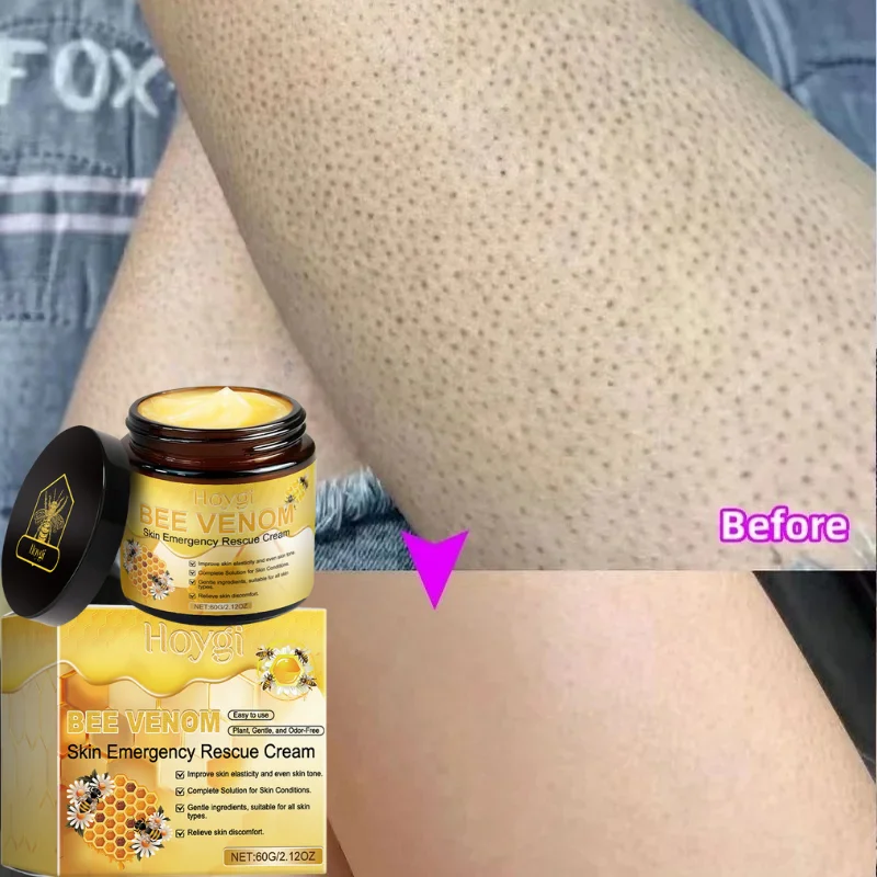 

Bee Venom Cream Relieves Redness Repair Damage Skin Strengthens Skin Barrier Deep Moisturizing Skin Care Nourishing Body Cream